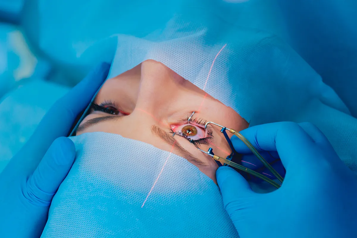 Blog cirurgia refrativa