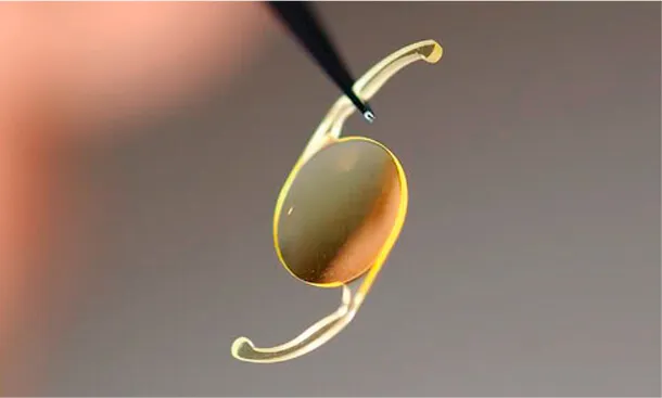 Blog lentes intraoculares monofocal 1